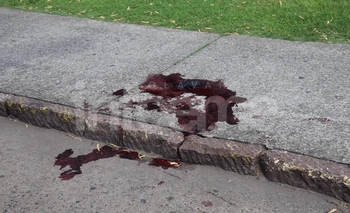 Imagen de la nota: Un adolescente gravemente herido durante los festejos de año nuevo