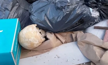 Imagen de la nota: Salió a dejar basura en un container y encontró un cráneo humano