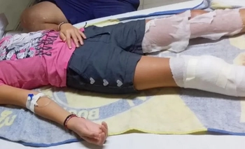 Imagen de la nota: Dos hermanos heridos por explosión de artefacto que hallaron en un basural