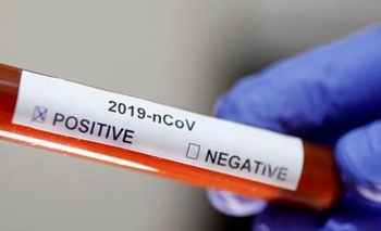 Imagen de la nota: Se registraron 8.183 contagios en Argentina