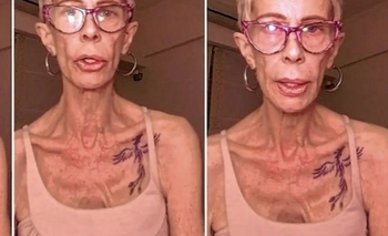 Imagen de la nota: Le detectaron un nuevo problema de salud a María Valenzuela 