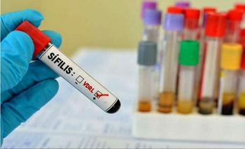 Imagen de la nota: La sífilis acecha: a abril se registraron más de 35 mil casos en la Provincia