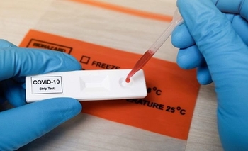 Imagen de la nota: La importancia de que los realicen los profesionales