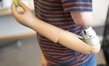 Imagen de la nota: Reducen en un 86% la espera de prótesis en hospitales bonaerenses