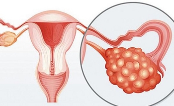 Imagen de la nota: En el silencio, la importancia del control anual