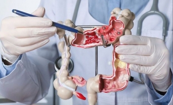 Impactante avance: nuevo fármaco reduce el avance del cáncer de colón metastásico Imagen de la nota: Impactante avance: nuevo fármaco reduce el avance del cáncer de colón metastásico