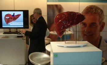 Imagen de la nota: Hay más de 500.000 argentinos que viven con hepatitis