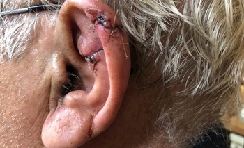 Imagen de la nota: Por miedo al COVID, le cosió la oreja un veterinario