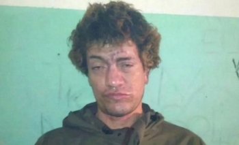 Imagen de la nota: Le sacaron una cucaracha viva del oído a “Pity” Álvarez