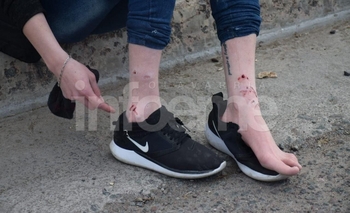 Imagen de la nota: ¡Cuidado con el perro! Visitó a una amiga y su perro la mordió 