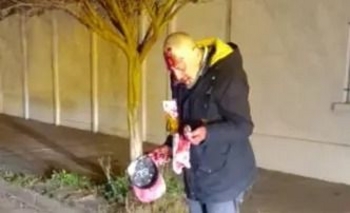 Adolescente golpeó a un anciano para robarle  Imagen de la nota: Adolescente golpeó a un anciano para robarle