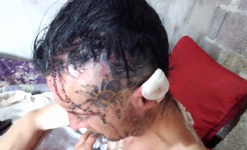 Imagen de la nota: Fue a la casa de su ex, lo golpeó y le dio 12 puñaladas