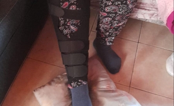 Chocó, tiene que operarse y  Imagen de la nota: Chocó, tiene que operarse y