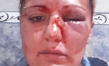 Imagen de la nota: “Pensé que me mataba”: salvaje golpiza a una mujer 