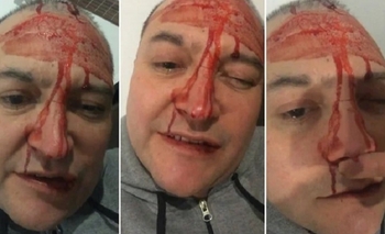 Imagen de la nota: Leo García sufrió una brutal agresión en un bar