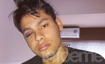 Imagen de la nota: Se fracturó jugando al fútbol y necesita $600.000 para operarse