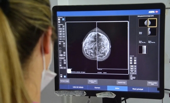 Imagen de la nota: Prevención del cáncer de mama: el gobierno bonaerense comenzará a indicar la mamografía a los 40 años