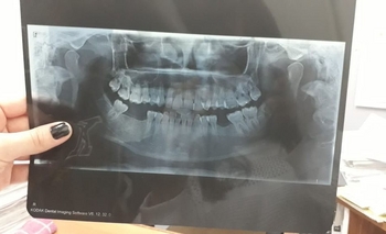 Imagen de la nota: Mujer denuncia agresión: “la policía me bajó los dientes”