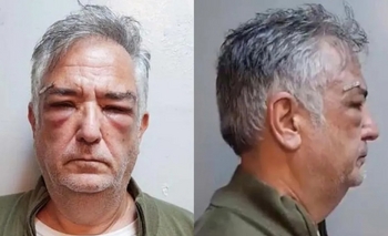 Imagen de la nota: Causa Andis: renunció un funcionario de la Oficina Anticorrupción que defendía a Calvete